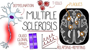 Understanding Multiple Sclerosis Multiple Sclerosis Explained [upl. by Arbas]