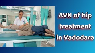 AVN Avascular Necrosis of hip treatment [upl. by Mastrianni]