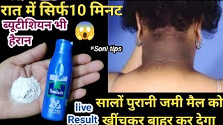 सालों पुरानी जमी मैल मिंटो में करें।।Skin care।। [upl. by Yesnil68]