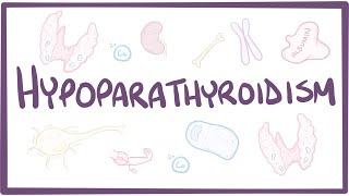 Hypoparathyroidism  causes symptoms diagnosis treatment pathology [upl. by Riaj868]