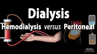 Renal Replacement Therapy Hemodialysis vs Peritoneal Dialysis Animation [upl. by Leonardi]