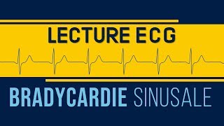 Interprétation ECG  Bradycardie Sinusale [upl. by Kynan]