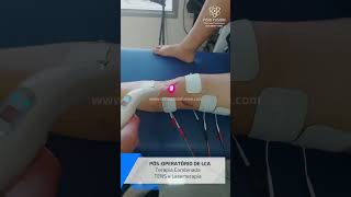 Pósoperatório de LCA  Terapia Combinada TENS e Laserterapia [upl. by Ahsenev]