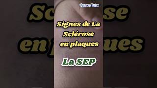 Signes Symptômes Sclérose en plaques SEP scleroseenplaques TroublesDuSommeil neurodegenerative [upl. by Ruon]