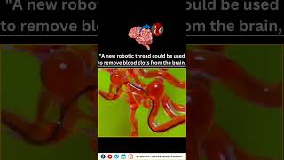 MITs Groundbreaking Magnetic Robot Thread A Game Changer for Brain Surgery amp Stroke Prevention [upl. by Brandice167]