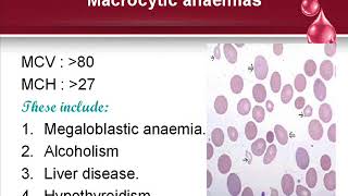 Classification of anaemia [upl. by Xirtaeb173]