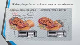 Intrapartum fetal surveillance [upl. by Frohman824]