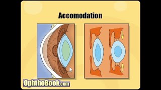 Optometry with Chanaka 11 Refractive Errors Sinhala [upl. by Annirac]