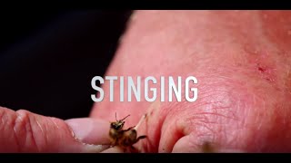 Stinging [upl. by Anail]