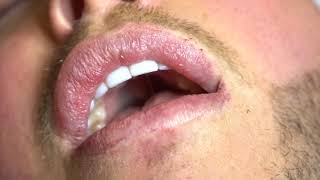 Scalpa Permanent Lips Training [upl. by Ailefo511]