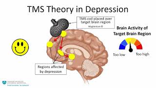 Transcranial Magnetic Stimulation A New Treatment Approach for Psychiatric Disorders [upl. by Nesta]