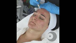 NANO Infusion  Oxygen Infusion with Skin Scrubber Technique Video [upl. by Carline]