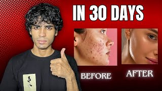 How to remove dark spots and pigmentation in 30 days [upl. by Kemeny]