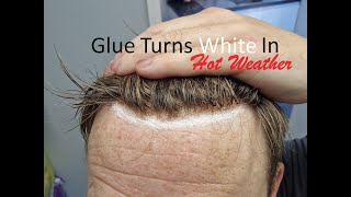 Hair System Fitting with Taped Hairline due to heat Then Glued Hairline Compared GLUE GOES WHITE [upl. by Trueman]