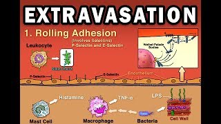 EXTRAVASATION [upl. by Blus]