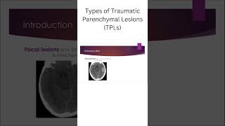 Types of Traumatic Parenchymal Lesions TPLs [upl. by Llerrod504]