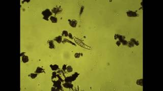 Bdelloidea Rotifer Philodina in motion [upl. by Ayardna]