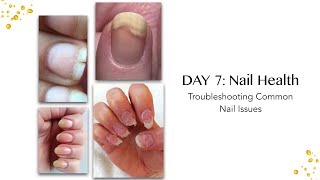 Bliss Kiss™ Challenge Day 7 Nail Health Trouble Shooting Common Nail Health Issues [upl. by Lilaj636]