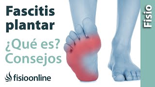 Qué es la fascia plantar y la fascitis plantar Tips para remediarla [upl. by Norred]