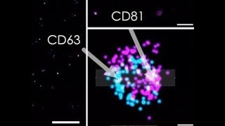 Duncan Ross PhD Advancements in Kimera Exosome Characterization [upl. by Alesi368]