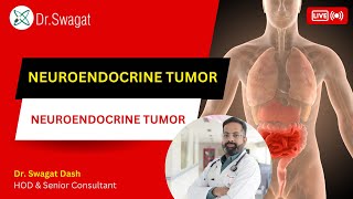 Neuroendocrine Cancer I Neuroendocrine Tumour in Hindi I Dr Swagat Dash [upl. by Essined]