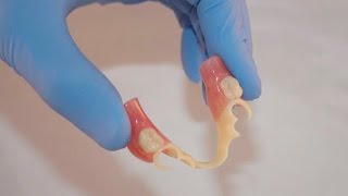 Bredent BioDentaplast Partial Dentures [upl. by Rheinlander]