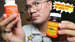 MYRA E 400 EFFECTIVE NGA BA 1 WEEK PRODUCT REVIEW  Dennis Vlog 51 [upl. by Adnylam]