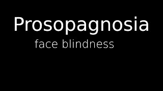 Prosopagnosia Face blindness 3 cases [upl. by Koller]