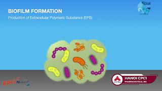 Why sinusitis is so stubborn and the effective treatment no antibiotic [upl. by Painter]