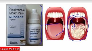 Nuforce Mouth Paint  Treatment of Mouth Fungal Infection  How to use and Benefits  Safety Tips [upl. by Seuguh]