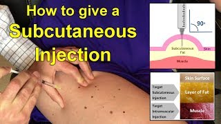 How to Give a Subcutaneous Injection Video [upl. by Eedissac]