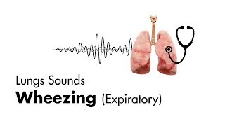 Wheezing expiratory  Lung Sounds  MEDZCOOL [upl. by Ruhtua]