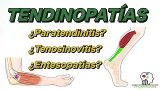 ¿Tendinitis o tendinosis Causas y tratamiento de las tendinopatías [upl. by Eversole]