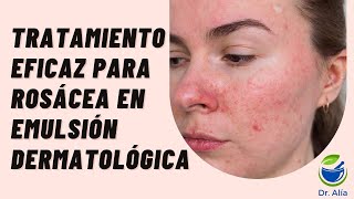 Crema para Rosácea Pápulopustulosa con Metronidazol Ivermectina y Alfa Bisabolol [upl. by Anjali831]