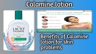 CALAMINE LOTION USES IN HINDI [upl. by Nonnaer]