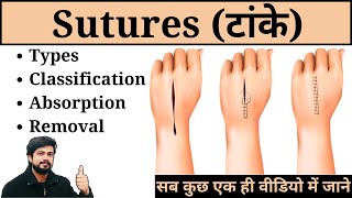 Sutures  Types Classification Removal and Absorption in Hindi  Nursing  Surgery  Medical  GNM [upl. by Naiviv]