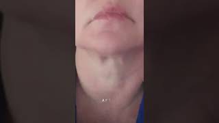 Fascia Blaster Neck Before And After Review  I Transformed My Neck with the FasciaBlaster [upl. by Ailel]