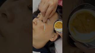 Pigmentation solution free at home shorts pigmentation skincondition diy viral youtube [upl. by Aowda]