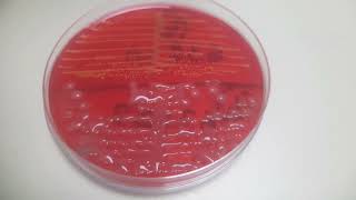 Klebsiella and Staphylococcus growth on CLED agar Uropathogens [upl. by Haven]