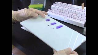 Testing Eggs for Salmonella at UMaine [upl. by Penrose]