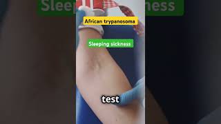 Trypanosoma ParasiteAwareness TsetseFly KissingBug Health DiseasePrevention MedicalEducation [upl. by Ahdar]