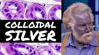 Argyria blue skin from colloidal silver under the microscope pathology dermpath dermatology [upl. by Siro]