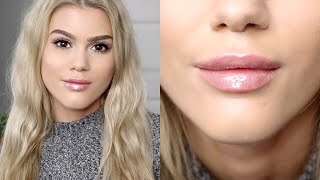 My Lip Filler Injection Experience [upl. by Sandberg]