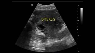 Extended  Rapid Ultrasound for Shock and Hypotension [upl. by John]