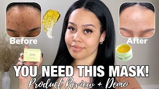 Versed Doctor’s Visit Instant Resurfacing Face Mask  Honest Review amp Demo [upl. by Lecram]