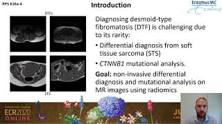 Distinguishing desmoidtype fibromatosis from soft tissue sarcoma on MRI using a radiomics approach [upl. by Valma]