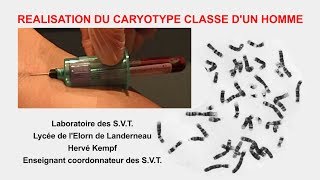 Réalisation dun caryotype humain classé SVT Hervé Kempf lycée de lElorn [upl. by Yentruoc3]