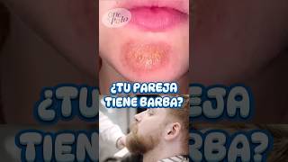 Cuida tu BARBA o causarás ESTO ✌🏻 más en IG medicina sabiasque curiosidades [upl. by Kennet]