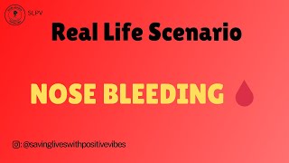 Nose Bleeding Real Life Scenario [upl. by Nylrad]