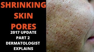 Skin Care Reducing large pores [upl. by Tlihcox193]